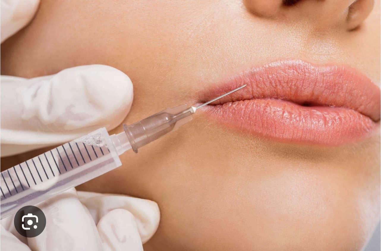 Dermal filler and anti-wrinkle treatment